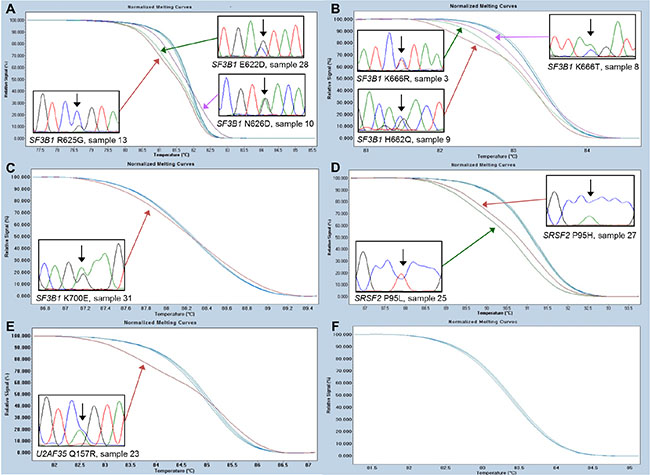 High-resolution melting assays for the detection of SF3B1, SRSF2, and U2AF35 mutations.