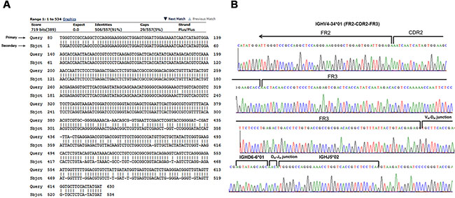 Nucleotide sequence of the rearranged Ig VH4&#x2013;34 genes cloned from a primary tumor and relapse (case #4).