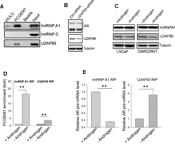 PCGEM1-hnRNP A1 interaction suppresses, whereas PCGEM1-U2AF65 interaction enhances AR3 expression.