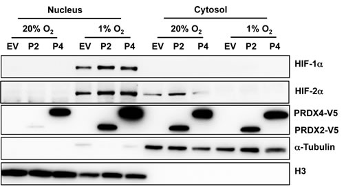 Hypoxia induces the nuclear translocation of PRDX2 and PRDX4.