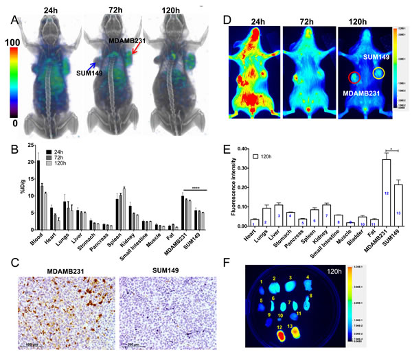Imaging PD-L1 expression in orthotopic breast cancer xenografts with [