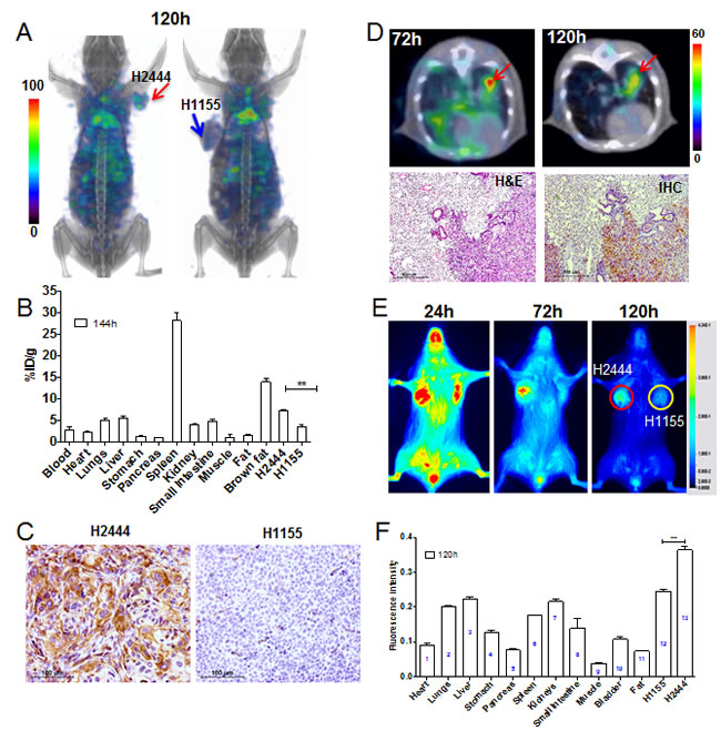 Imaging PD-L1 expression in subcutaneous and orthotopic lung cancer xenografts with [