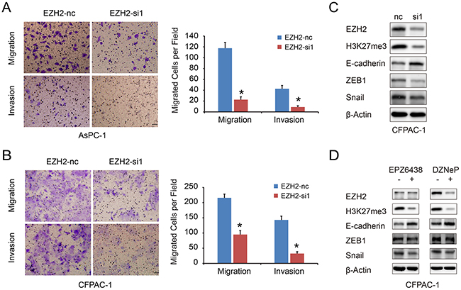 EZH2 knockdown in pancreatic cancer cells inhibits cell migration and invasion.