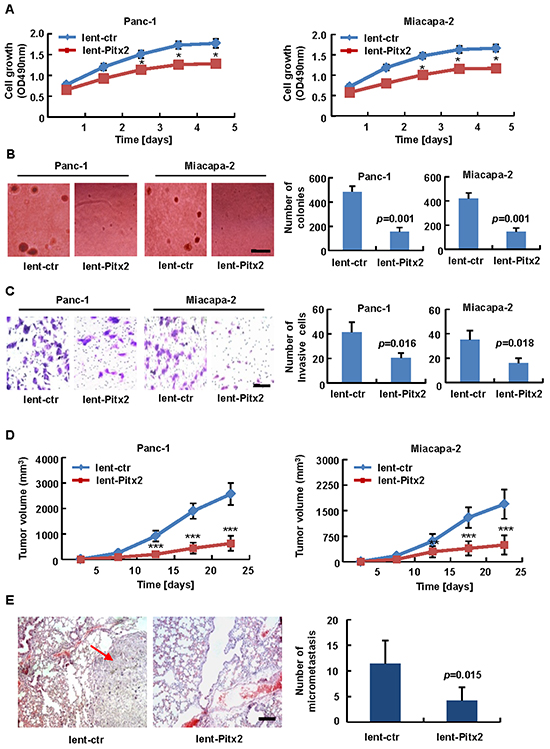 Biological role of Pitx2 in pancreatic carcinogenesis.