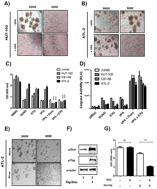 doxorubicin and etoposide-induced cell death in ATL cells lines co-treated with Valproate.