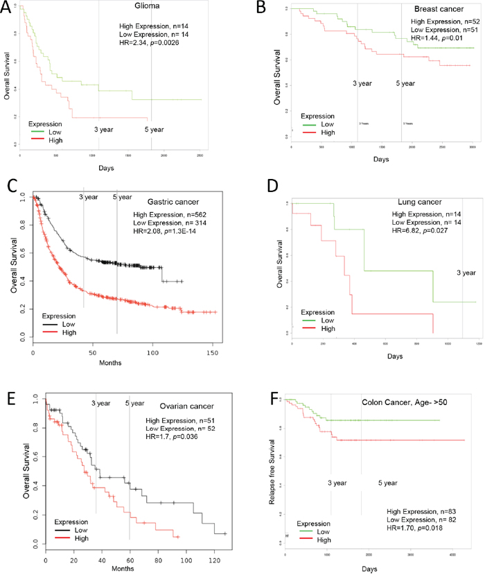 Increased Ly6E expression in cancer and patient survival.