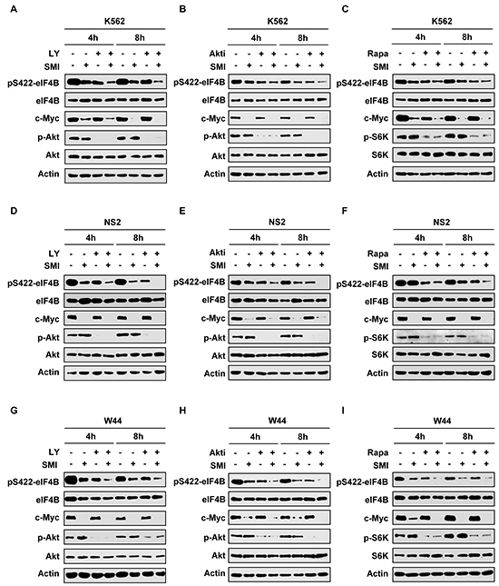 Combined inhibition of Pim and PI3K/Akt/mTOR signaling impairs eIF4B phosphorylation more effectively than suppressing one pathway alone.