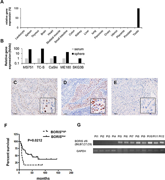 The cancer/testis gene BORIS is preferentially expressed in CSCs and BORIS expression is a marker of poor prognosis for patients with advanced cervical cancer.