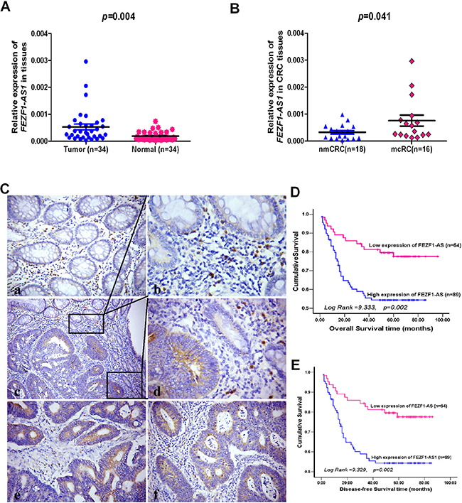 The levels of FEZF1-AS1 expression in CRC tissues by qRT-PCR or in situ hybridization and its prognostic value in patients with CRC.