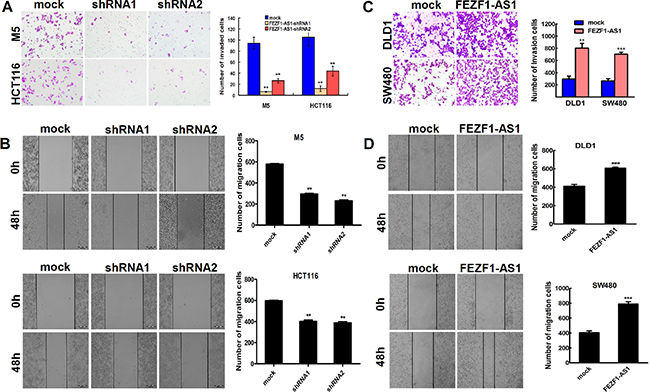 FEZF1-AS1 promotes migration and invasion of CRC cells in vitro.