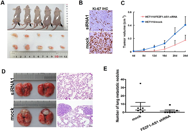Knockdwon of FEZF1-AS1 repressed CRC growth, invasion and metastasis in vivo.
