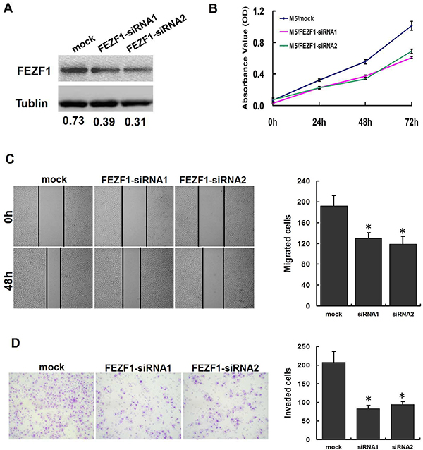 Knockdown of FEZF1 inhibited proliferation, invasiveness and migration of CRC cells in vitro.