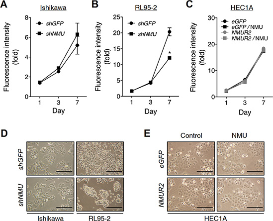 Effects of NMU knockdown on the cell growth and morphology of endometrial cancer cells.