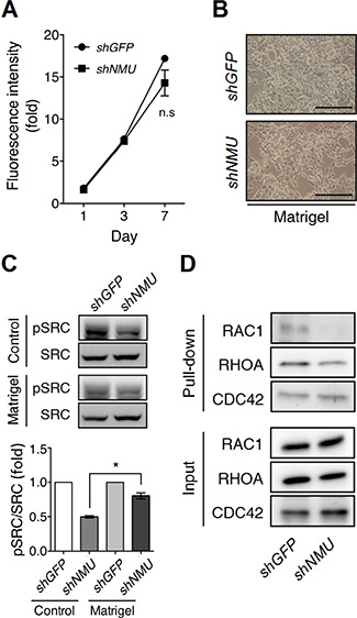 Matrigel culture remedies the effects of NMU knockdown in RL95-2 cells.