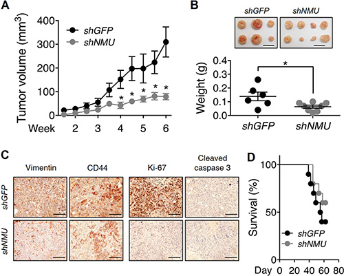 Effects of NMU knockdown on tumor growth and animal survival rate in vivo.