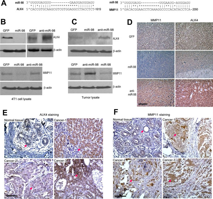Targeting of ALK4 and MMP11 by miR-98.