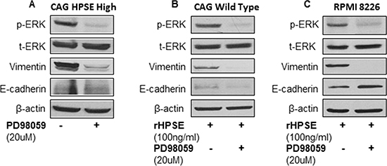 ERK signaling inhibitor reverses vimentin expression in myeloma cells.