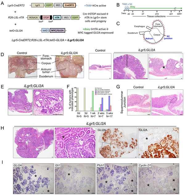 GLI2A expression in Lgr5+ stem cells drives rapid development of invasive gastric adenocarcinoma.
