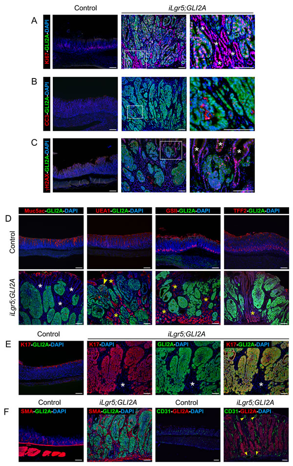 Proliferation and lineage marker expression in GLI2A-driven gastric adenocarcinomas.