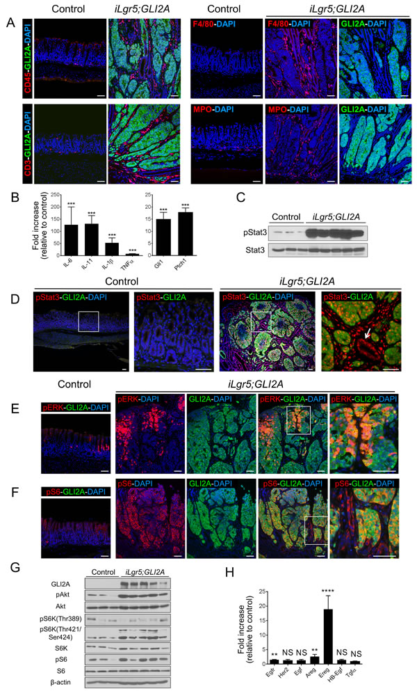 Inflammation and signaling alterations in GLI2A-driven gastric adenocarcinomas.