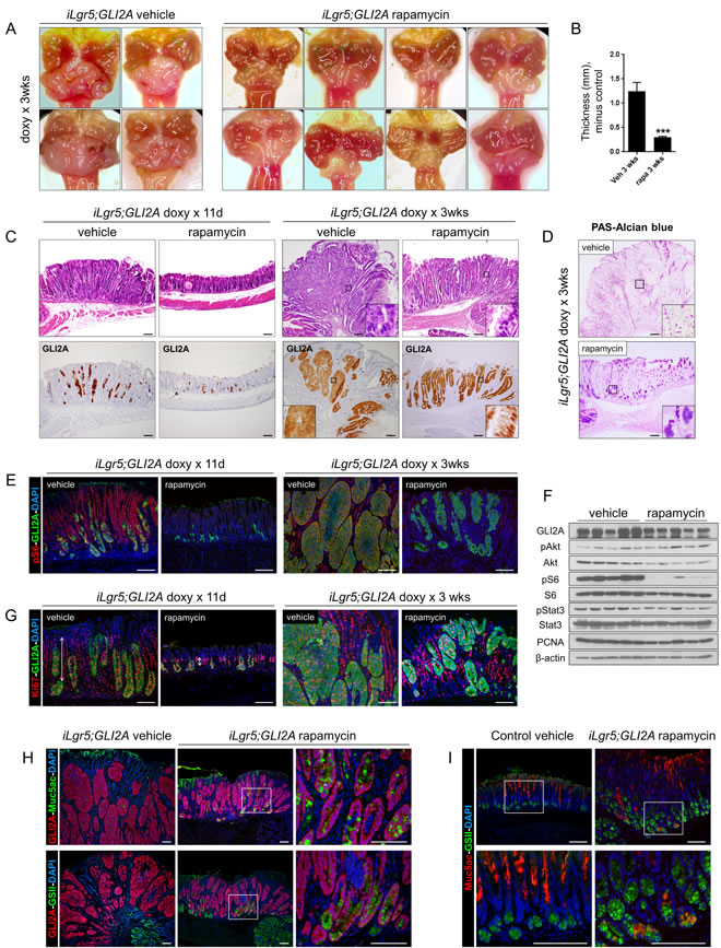 mTOR signaling contributes to growth of GLI2A-driven gastric cancers.