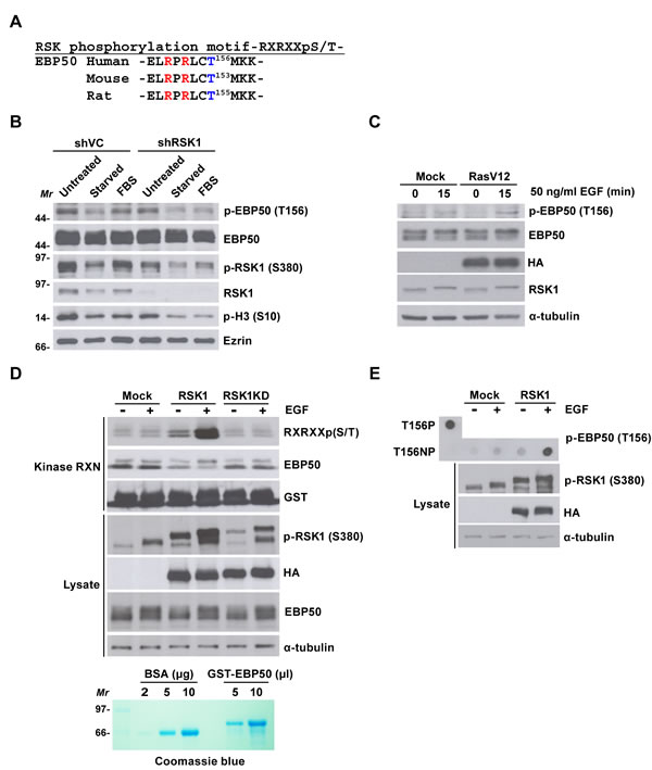 RSK1 phosphorylates EBP50 at T156 within a consensus RXRXXpS/T motif.