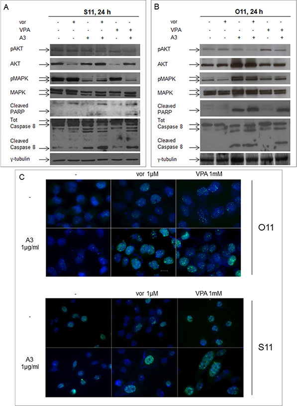 Synergistic modulation of mitogenic signaling as well as of DNA-damage and apoptosis by HDACi and A3 combination treatment in MPE cells.