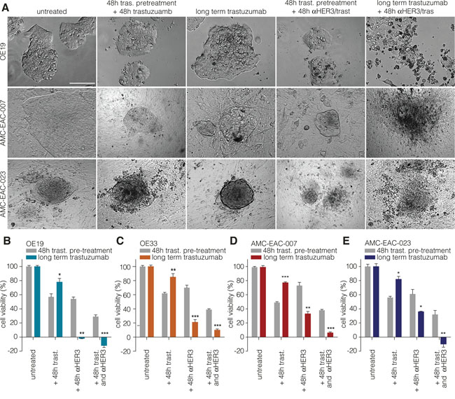 Targeting HER3 overcomes resistance to trastuzumab in cell lines and primary cells.