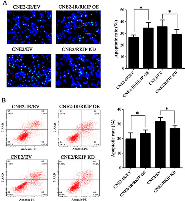 RKIP reduction inhibits irradiation-induced NPC cell apoptosis.