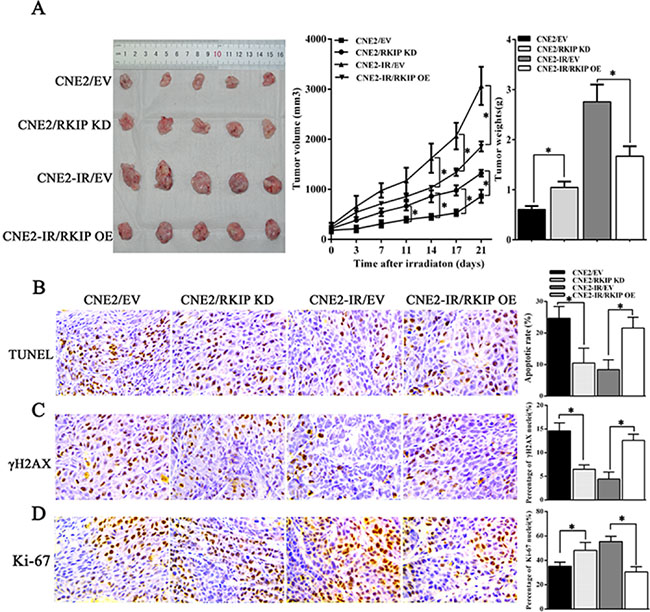 RKIP reduction increases NPC cell radioresistance in vivo.