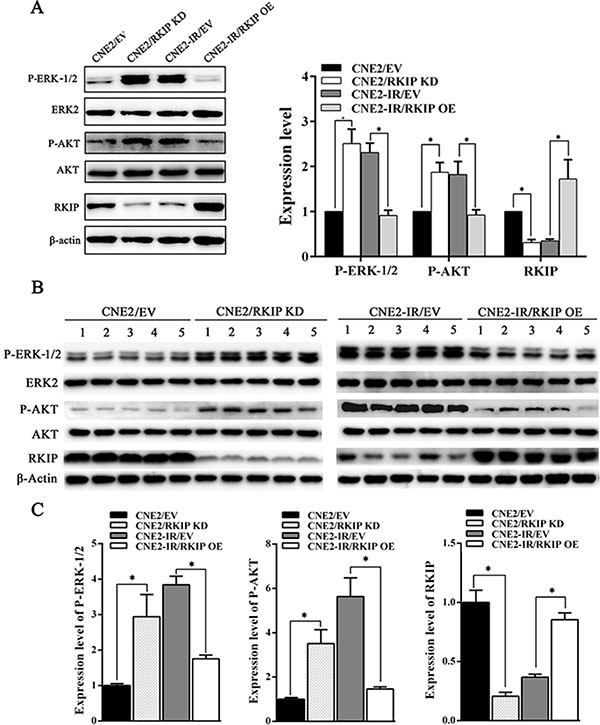 RKIP inhibits activity of ERK-1/2 and AKT signaling in the irradiated NPC cells and xenograft tumors.