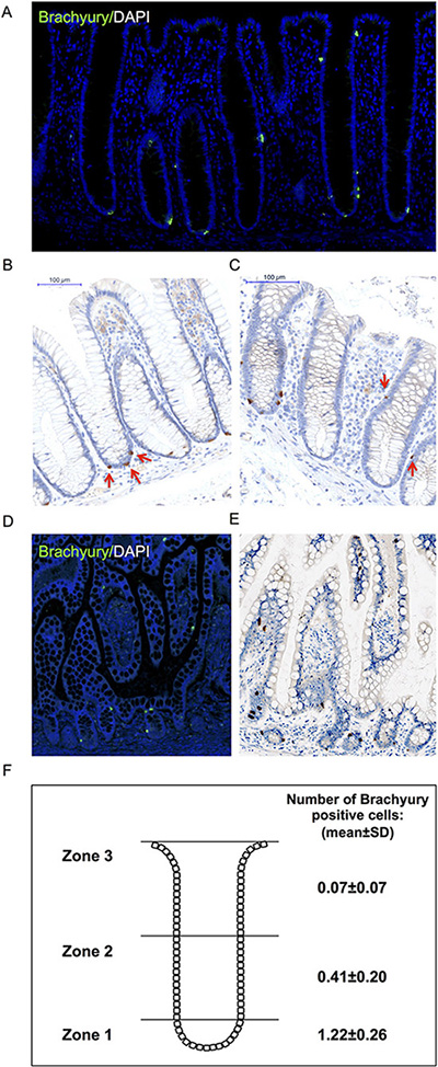 Immuno-detection of Brachyury in normal human intestinal crypts.