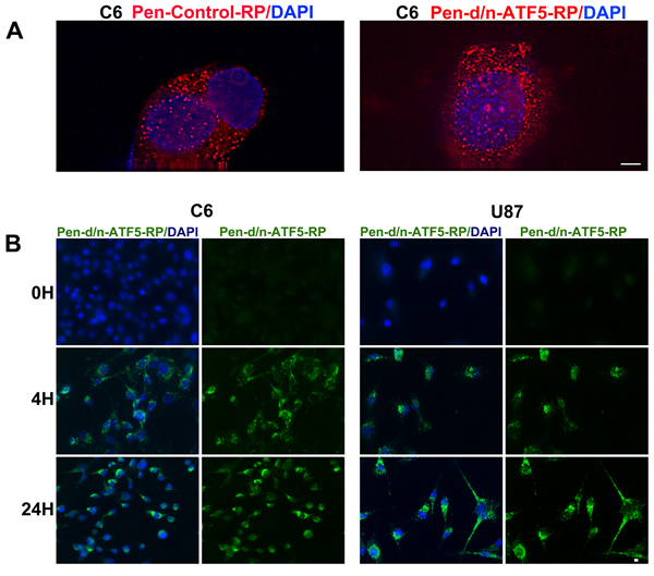 Uptake and retention of Pen-d/n-ATF5-RP by cultured glioblastoma cells.