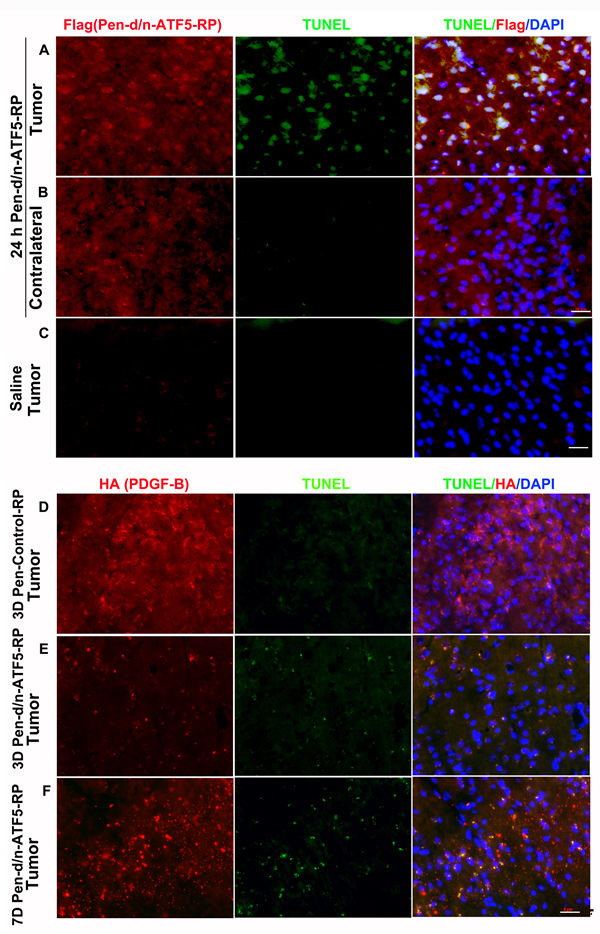 Pen-d/n-ATF5-RP enters the mouse brain and causes targeted apoptosis of glioma cells.