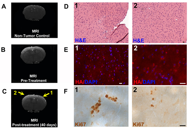 Example of MRI and histopathology of a mouse glioma treated with Pen-Control-RP peptide.
