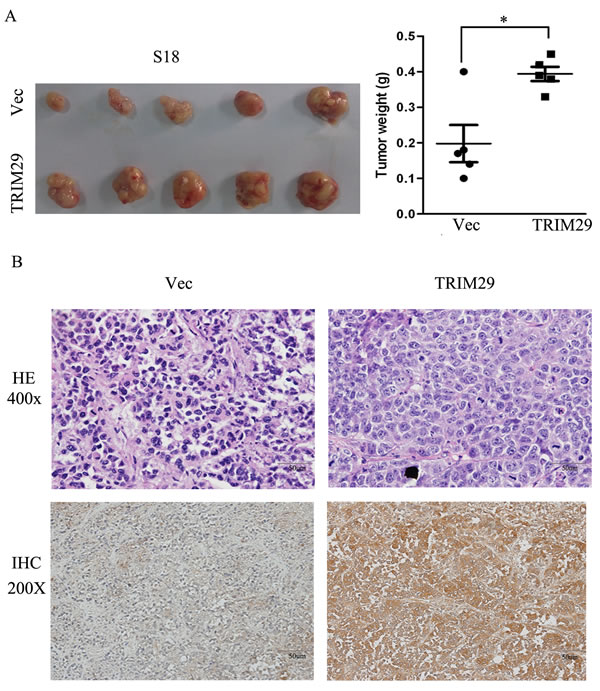 TRIM29 over-expression promotes NPC tumor growth in xenograft nude mice.