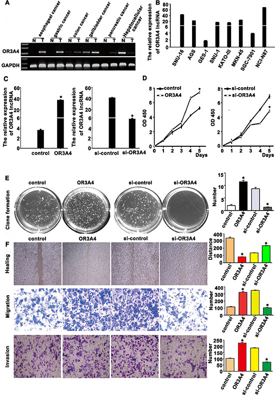 OR3A4 promotes proliferation, migration, and invasion in gastric cancer cells.