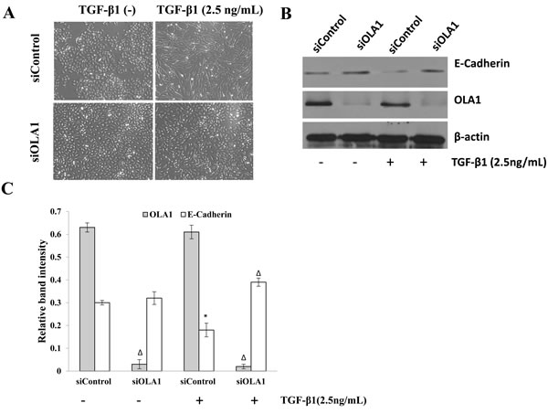 Knockdown of OLA1 results in attenuation of TGF-&#x3b2;1-induced EMT in A549 cells.