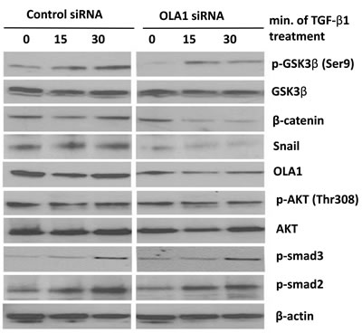 Knockdown of OLA1 inhibited EMT by regulating GSK3&#x3b2;/Snail pathway.