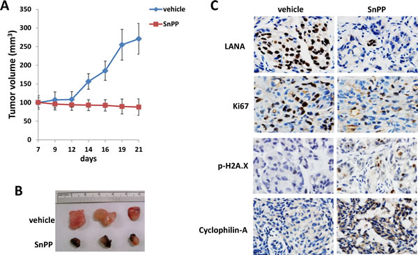 Targeting HO-1 by SnPP effectively suppresses TIVE-LTC tumorigenesis in vivo.