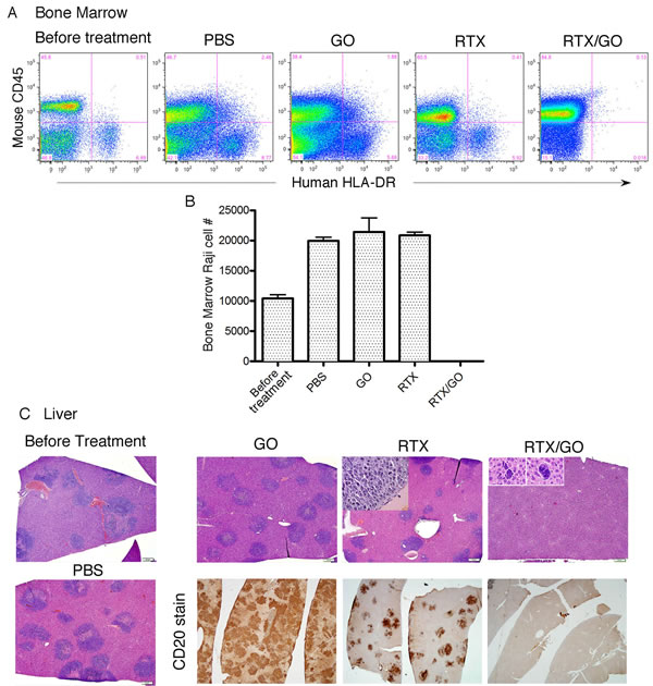 Therapeutic capacity of RTX/GO in NRG mice: Bone marrow cells from lymphoma-transplanted mice before or after receiving the indicated treatments were stained with mouse CD45 and human HLA-DR and analyzed by flow cytometry.