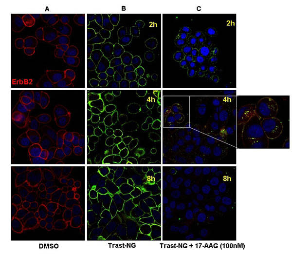 The HSP90 inhibitor 17AAG promotes the internalization and lysosomal degradation of Trast-NG.