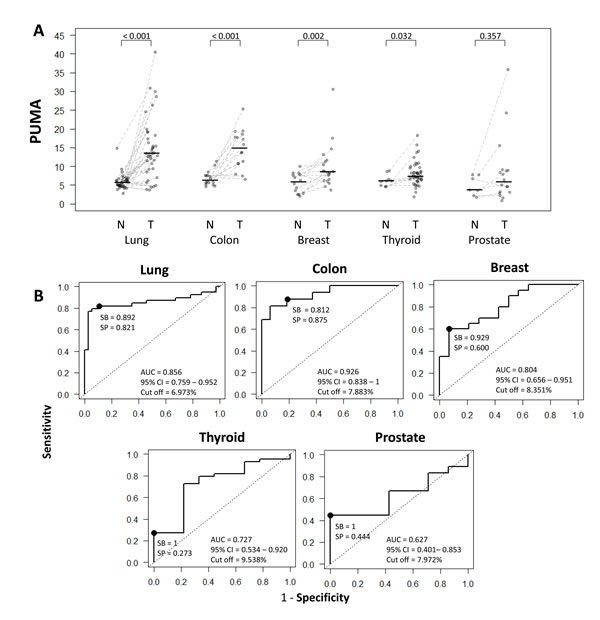 Comparison and diagnostic value of QUAlu among different cancer types.