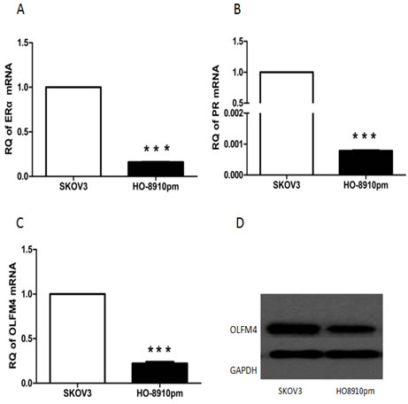 Expression of ER&#x3b1;