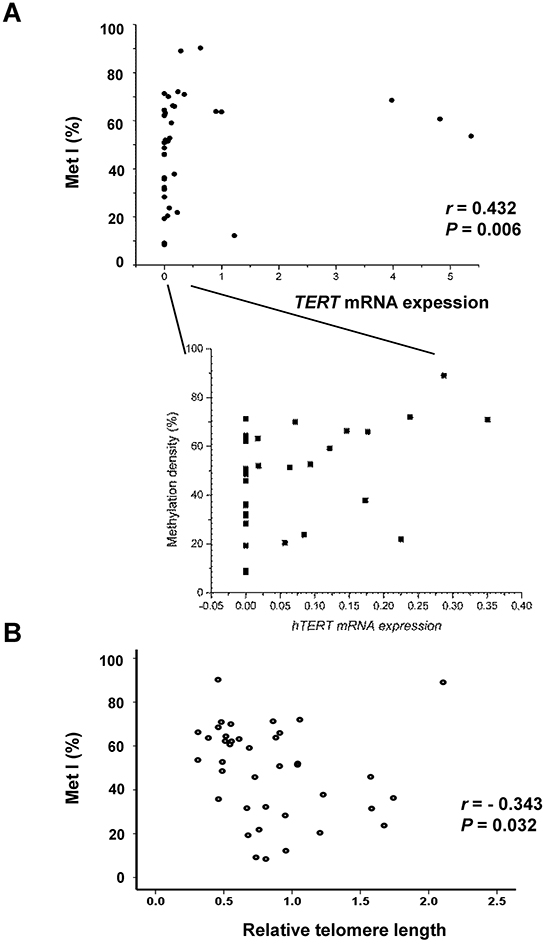 Comparisons of TERT promoter methylation index (Met I) with TERT gene expression and telomere length in the 39 sporadic MTCs.