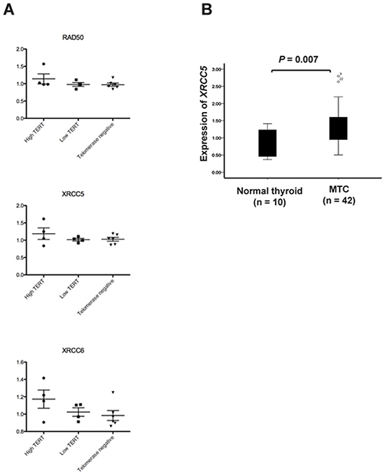 Expression of XRCC5 (Ku80), XRCC6 (Ku70) and RAD50 in sporadic MTCs.