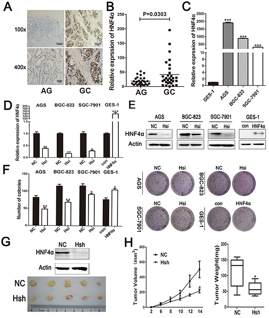 Expression ofHNF4&#x03B1; in clinical gastric tissues and its role in regulating gastric cell proliferation.