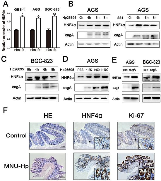 HNF4&#x03B1; expression level was up-regulated by Hpinfection in vitro and in vivo.