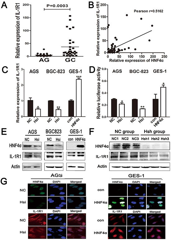 IL-1R1 is up-regulated in gastric cancer tissues and it is the direct target of HNF4&#x03B1;.