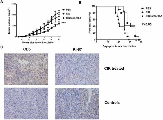 In vivo cytotoxicity of CIK cells against murine gastric cancer model.